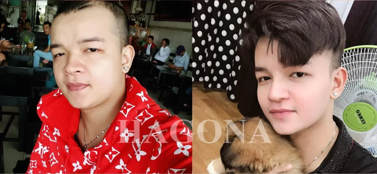 kiểu tóc cho nam đầu hói