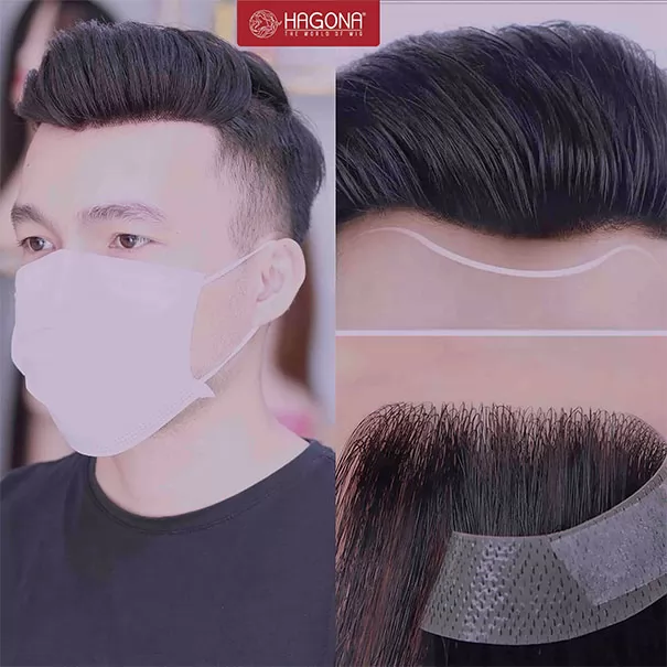 Tóc mái hói chữ M nam
