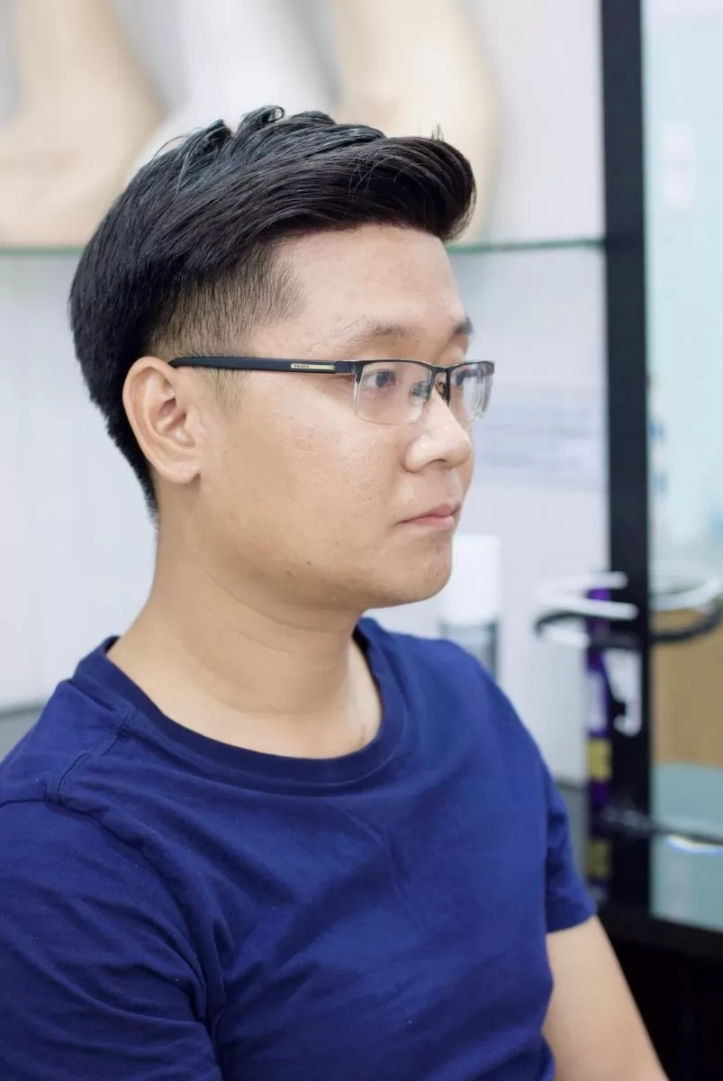 tóc giả nam cho người hói