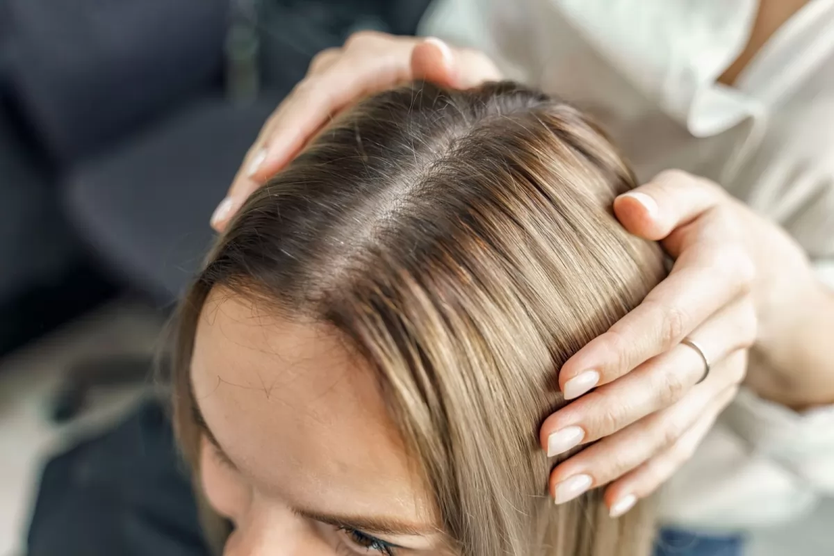 Tóc Rụng Rụng Ở Đỉnh Đầu: Nguyên Nhân Và Cách Khắc Phục