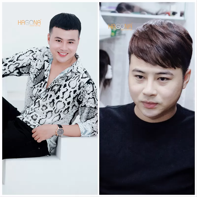 Tóc mái cho người hói trán cao