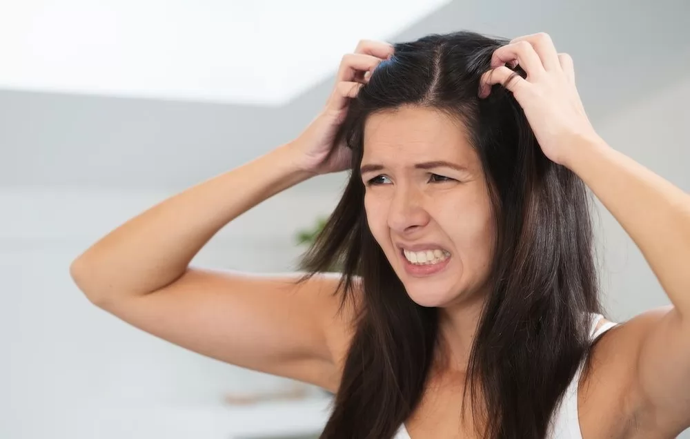 5 câu hỏi thường gặp về gàu được chuyên gia giải đáp