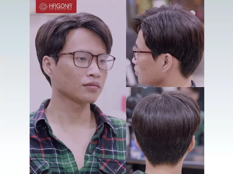 tóc giả che hói nam