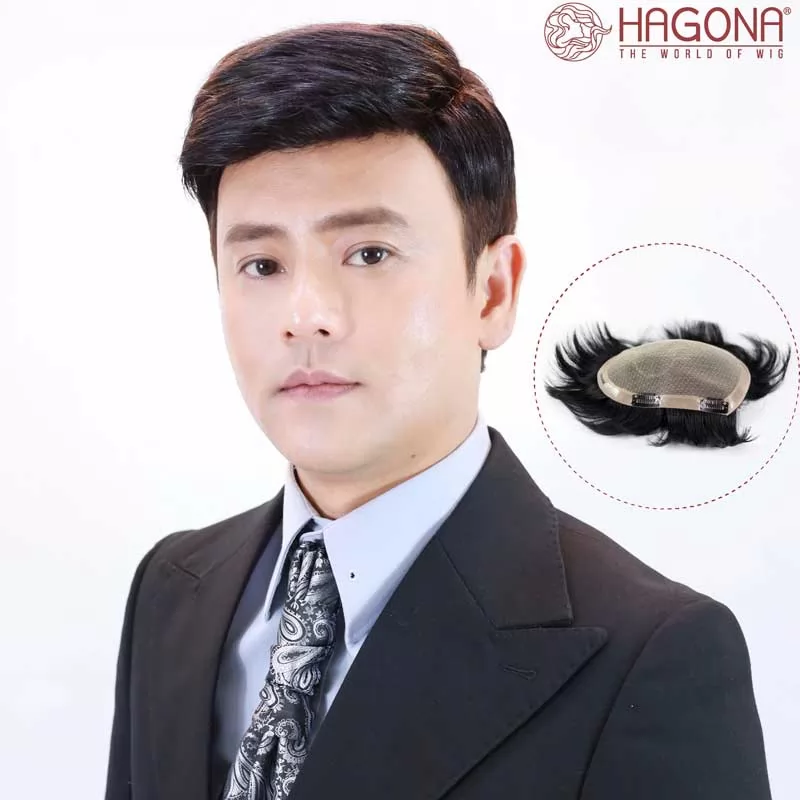 Tóc giả mái hói nam là gì? Những ưu điểm của tóc giả mái hói nam