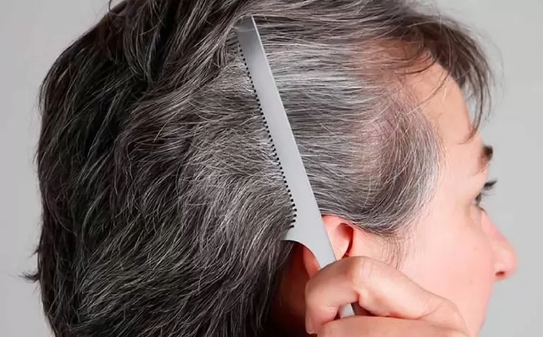 Tóc phụ nữ trung niên thay đổi về mật độ và màu sắc