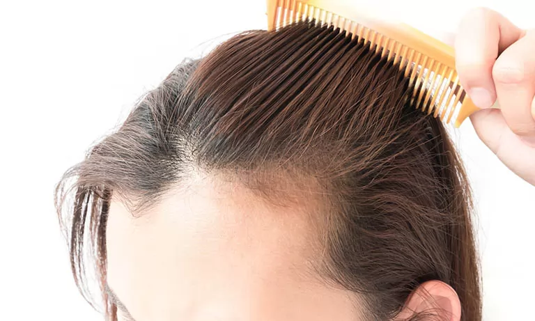 12 lý do tại sao tóc của bạn ngừng phát triển