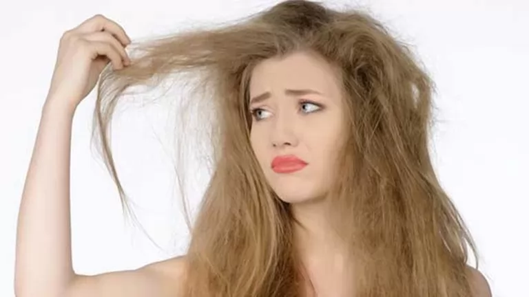 Trị gàu: 5 triệu chứng của tóc gàu và cách điều điều trị cơ bản