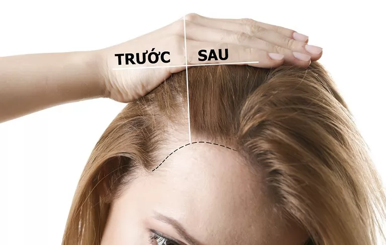 Bạn đã biết tóc mọc thế nào chưa?