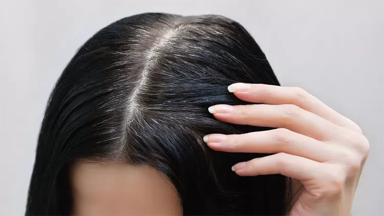 Cách điều trị tóc bạc sớm: Nguyên nhân, cách chữa và mẹo ngăn ngừa