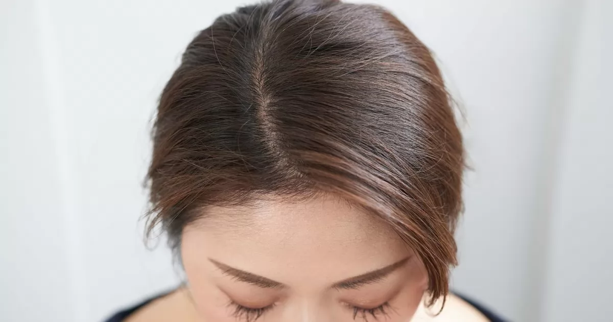 5 cách giúp hạn chế tóc bết trong mùa hè hiệu quả nhất