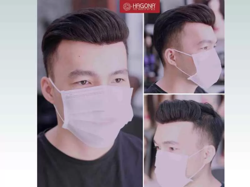 Tóc dán mái hói chữ M là gì? Vì sao nên chọn tóc dán mái hói chữ M