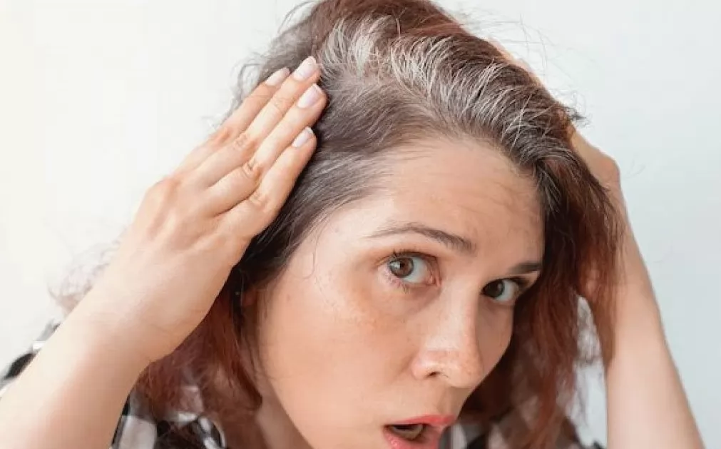 Phụ nữ nhận thấy tóc thưa ở vùng đầu