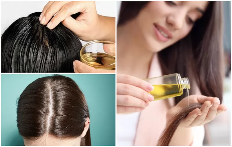 6 Cách sử dụng dầu ô liu để điều trị gàu hiệu quả tại nhà