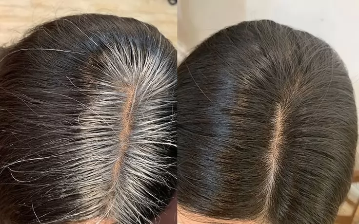 Tóc bạc tại đường ngôi trước và sau khi che màu