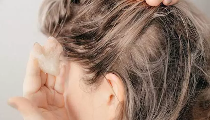 Cách tẩy tế bào chết cho da đầu tại nhà để loại bỏ dầu thừa