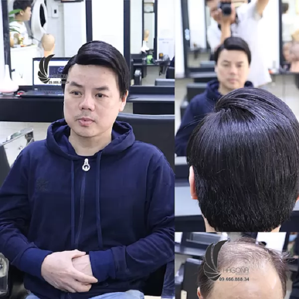 tóc giả nam cả đầu