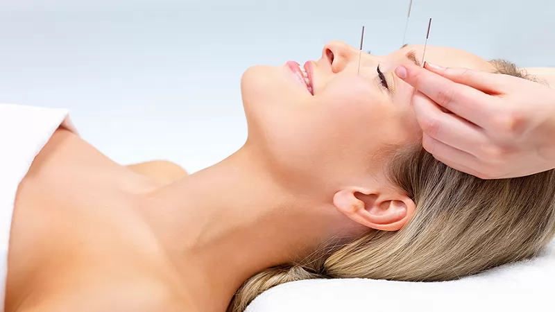 Châm cứu có thể điều trị rụng tóc hói đầu ở nam và nữ được không?