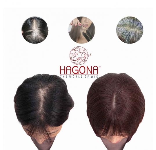 Tóc giả che hói HGN H05