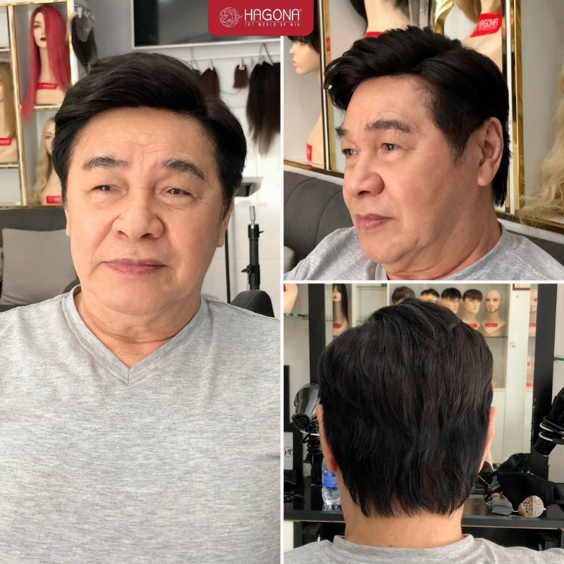 gắn tóc giả nam