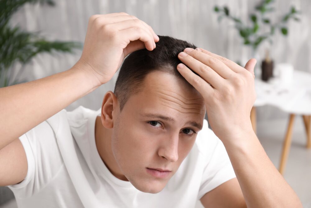 Nguyên Nhân Khiến Tóc Nam Trở Nên Mỏng