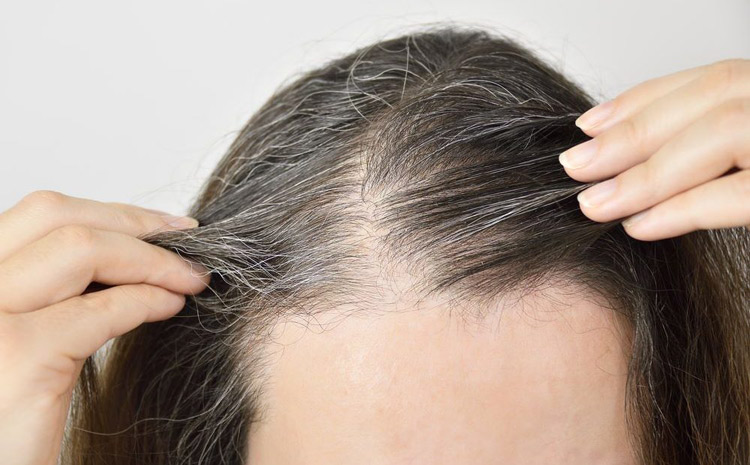 Nguyên nhân khiến tóc bạc sớm là gì? Cách khắc phục tình trạng tóc bạc sớm ở người trẻ