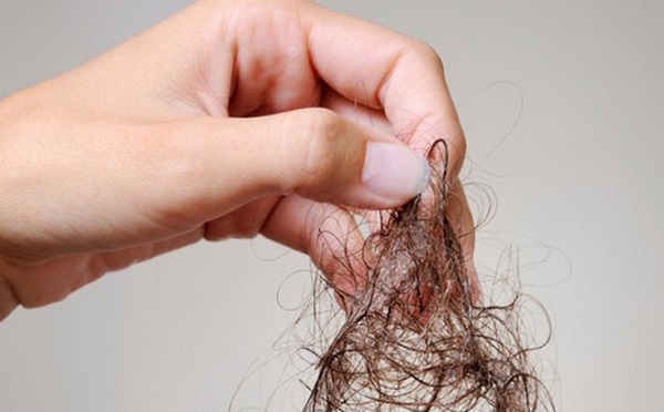 Nguyên nhân nào dẫn đến tóc rụng bất thường?