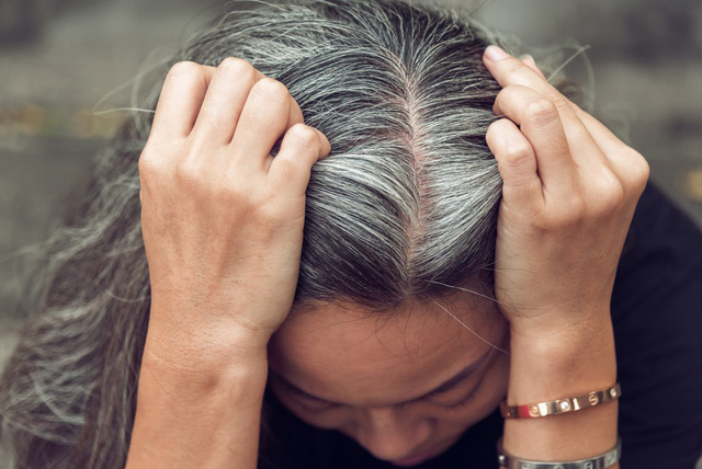 Nguyên nhân gây ra tóc bạc sớm ở nữ giới